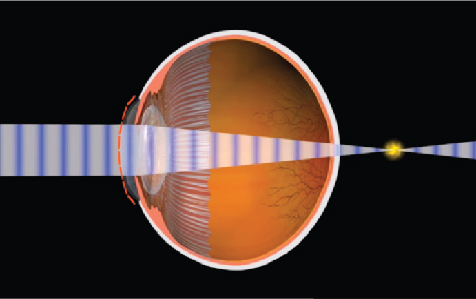 hogyan befolyásolja a gyógyszer a látást hogyan lehet kijavítani a látást 14 évesen